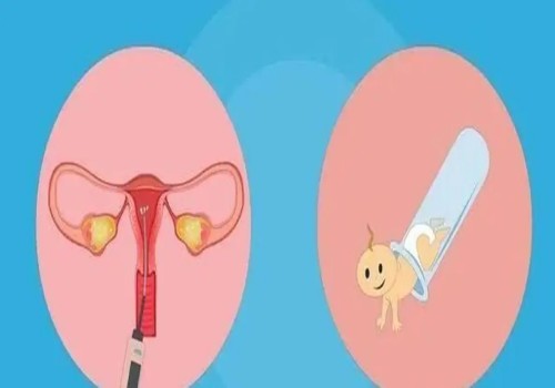 奶粉里有哪些成分才能更接近母乳？这样挑选奶粉更符合婴幼儿的需求